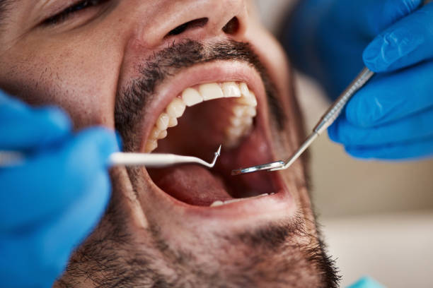Best Emergency Dental Care for Abscessed Tooth in New Carrollton, MD