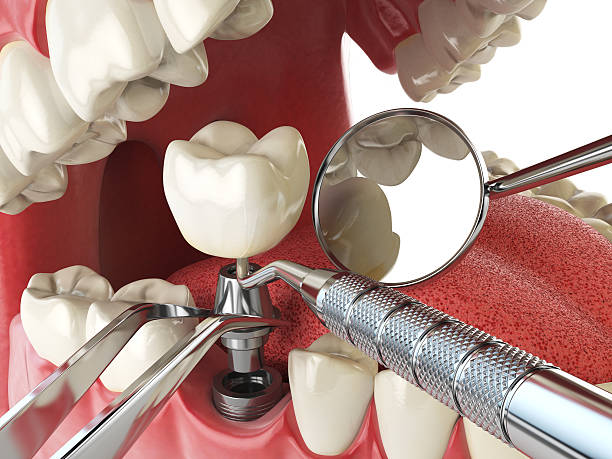 Best Orthodontic Emergency Dentist in New Carrollton, MD