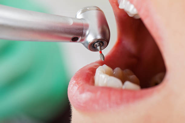 Best Emergency Cosmetic Dentistry in New Carrollton, MD